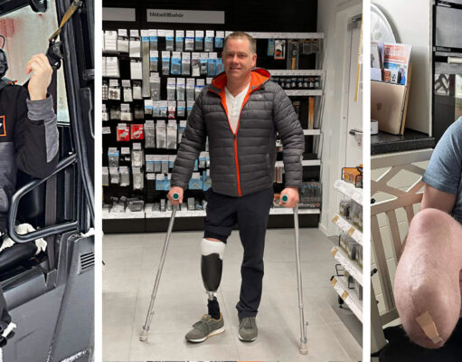 Protesen stoppar inte deltidaren Michael Andersson Michael Anderssons benprotes