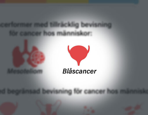 Cancer i urinblåsan urinblåsecancer - tema brandmannacancer